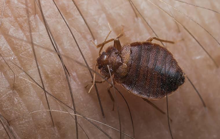 a bed bug on the skin of a person in palm valley florida