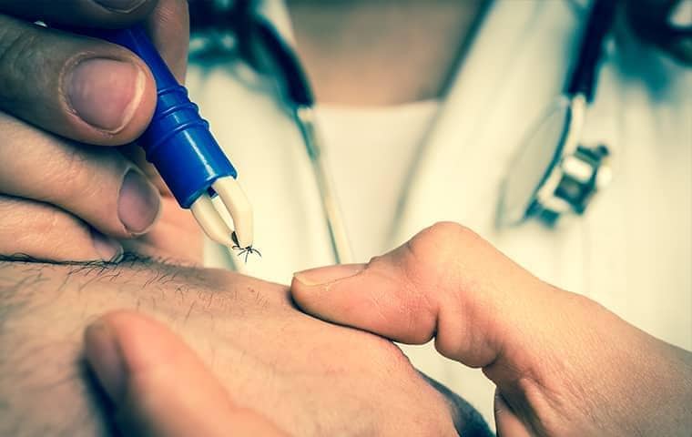 doctor removing a tick from a mans hand