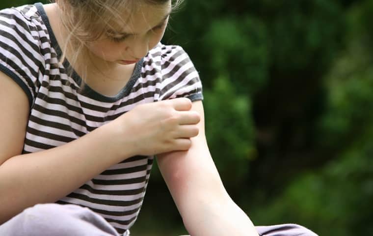 girl looking at a mosquite bite