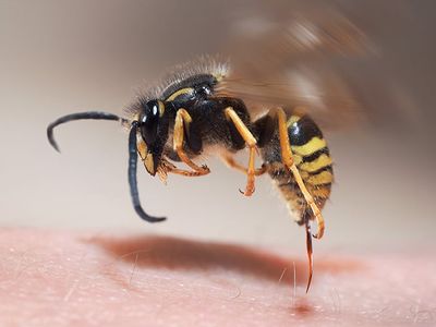 wasp stinging Albuquerque resident