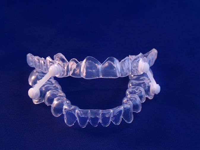 sleep apnea may be treated with an oral appliance