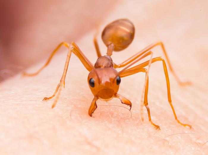 how to stop a fire ant sting from hurting