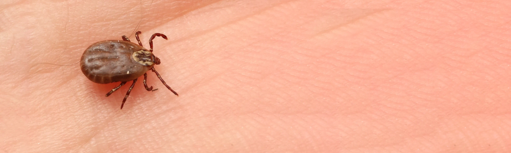 Rose Pest Solutions can help identify ticks tick crawling on skin