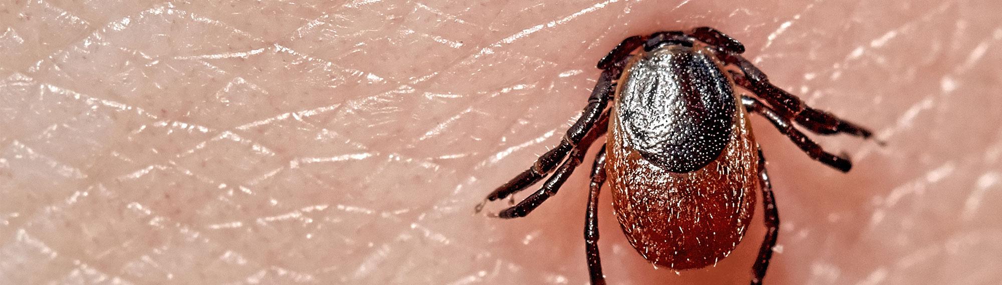 embedded tick