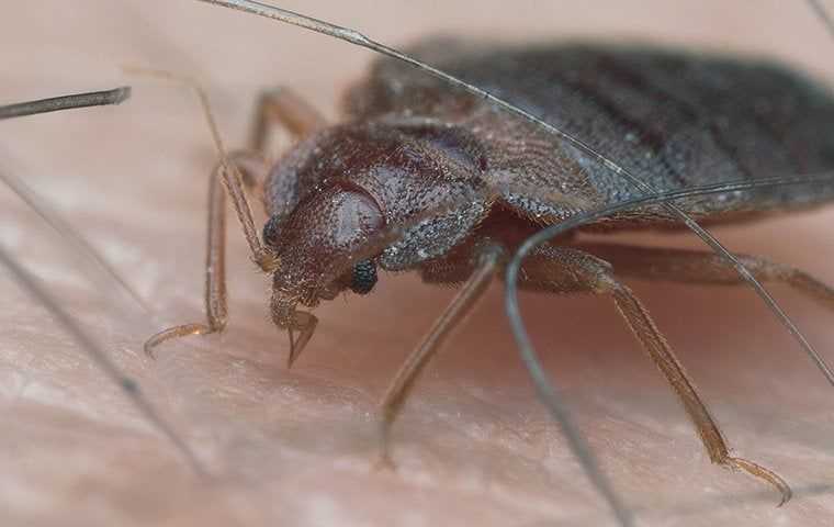 bed bug biting on skin