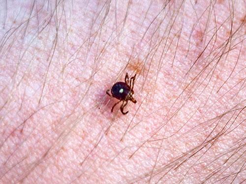 lone star tick attached to new jersey resident
