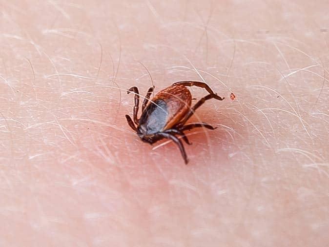 lyme disease carrying tick attached to monclair homeowner