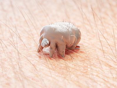 rendering of a scabies mite feeding on a new jersey homeowner