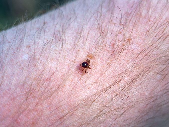 lone star tick on a new jersey residents arm