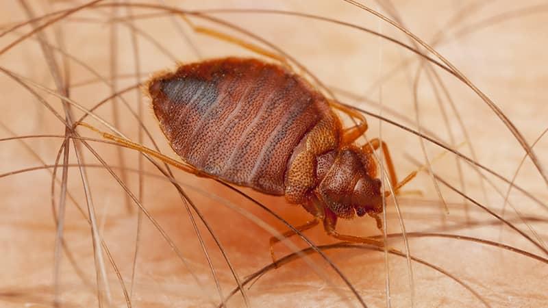 bed bug biting